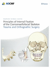 Principles of Internal Fixation of the Craniomaxillofacial Skeleton -  Joachim Prein,  Michael Ehrenfeld,  Paul N. Manson