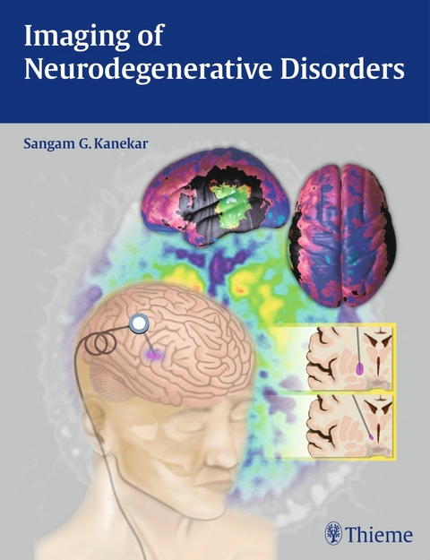 Imaging of Neurodegenerative Disorders - 