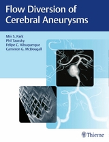Flow Diversion of Cerebral Aneurysms - Min S. Park, Phil Taussky, Felipe C. Albuquerque, Cameron G. McDougall