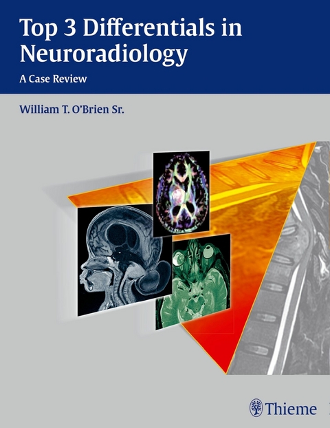 Top 3 Differentials in Neuroradiology - William T. O'Brien