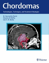 Chordomas - 