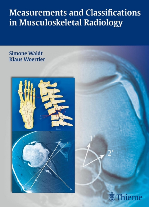 Measurements and Classifications in Musculoskeletal Radiology - Simone Waldt, Klaus Wörtler