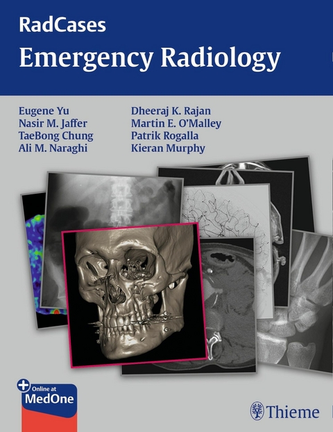 Radcases Emergency Radiology - Eugene Yu, Nasir Jaffer, Taebong Chung, Ali M. Naraghi, Dheeraj Rajan, Kieran Murphy, Martin O'Malley