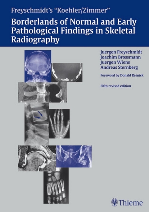 Freyschmidt's 'Koehler/Zimmer' Borderlands of Normal and Early Pathological Findings in Skeletal Radiography -  Jürgen Freyschmidt,  Joachim Brossmann,  Andreas Sternberg,  Jürgen Wiens