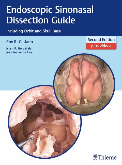 Endoscopic Sinonasal Dissection Guide - Roy R. Casiano, Islam Herzallah, Jean Eloy