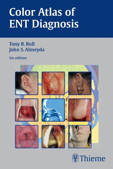 Color Atlas of ENT Diagnosis - Tony R. Bull, John S. Almeyda