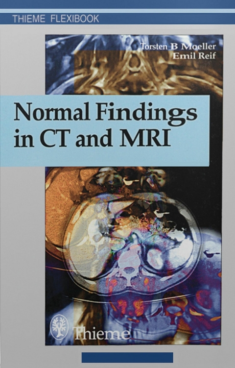 Normal Findings in CT and MRI - Torsten Bert Moeller, Emil Reif