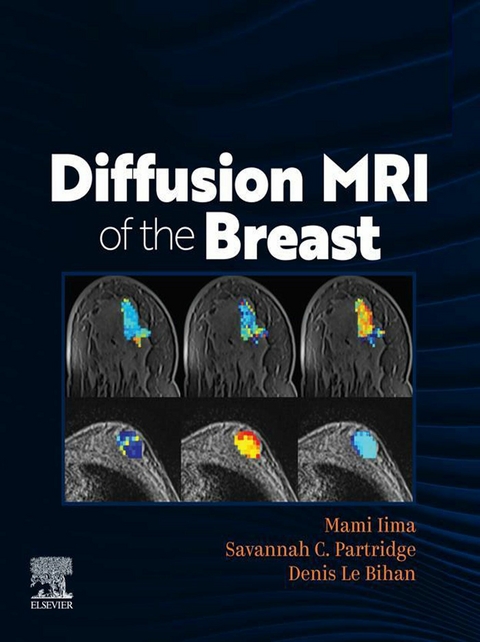 DIFFUSION MRI OF THE BREAST - 