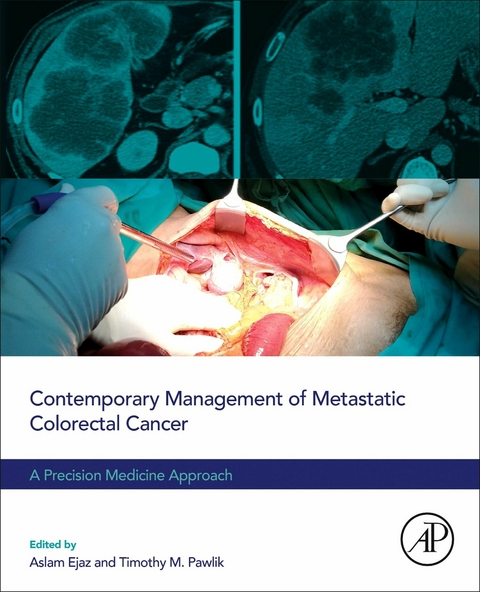 Contemporary Management of Metastatic Colorectal Cancer - 