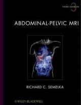 Abdominal-pelvic MRI - Semelka, Richard C.