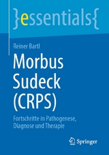 Morbus Sudeck (CRPS) -  Reiner Bartl