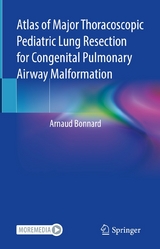 Atlas of Major Thoracoscopic Pediatric Lung Resection for Congenital Pulmonary Airway Malformation - Arnaud Bonnard