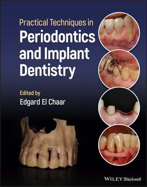 Practical Techniques in Periodontics and Implant Dentistry - 