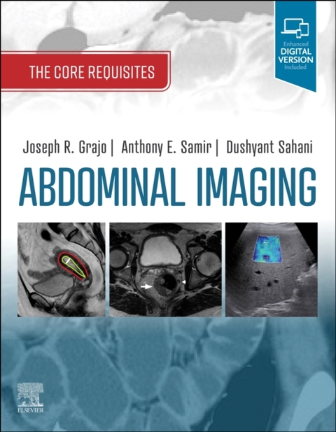 Abdominal Imaging -  Joseph R. Grajo,  Dushyant V Sahani,  Anthony E Samir