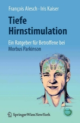 Tiefe Hirnstimulation: Ein Ratgeber für Betroffene bei Morbus Parkinson - François Alesch, Iris Kaiser