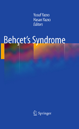 Behçet’s Syndrome - 