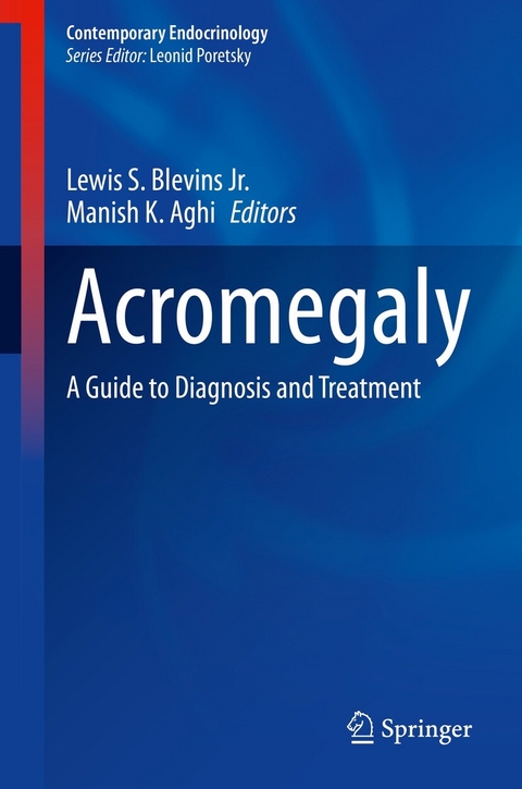 Acromegaly - 
