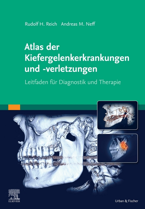 Atlas der Kiefergelenkerkrankungen und -verletzungen - 