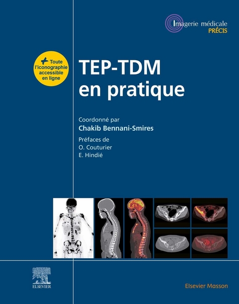 TEP-TDM en pratique -  Chakib Bennani Smires