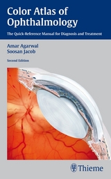 Color Atlas of Ophthalmology - 