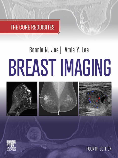 Breast Imaging -  Bonnie N. Joe,  Amie Y. Lee