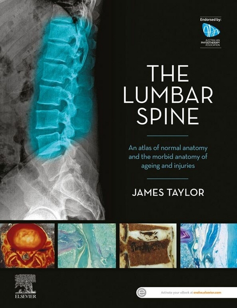 Lumbar Spine -  James Taylor