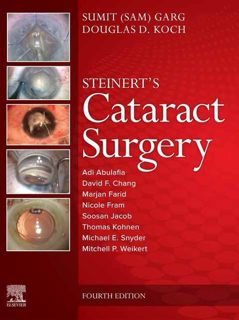Cataract Surgery -  Sumit Garg,  Douglas D. Koch