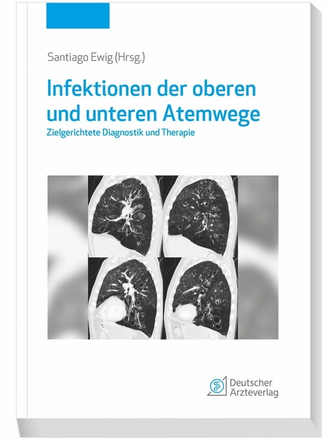 Infektionen der oberen und unteren Atemwege - 