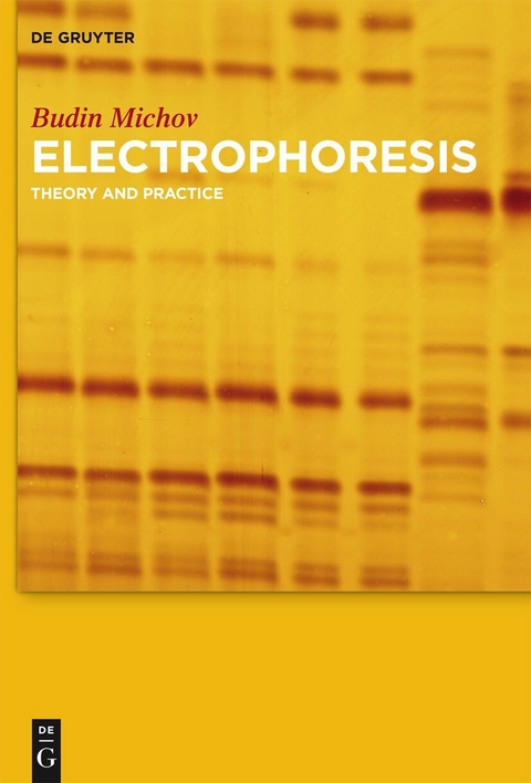 Electrophoresis -  Budin Michov