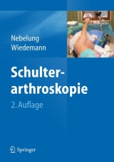 Schulterarthroskopie - Nebelung, Wolfgang; Wiedemann, Ernst
