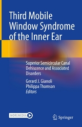 Third Mobile Window Syndrome of the Inner Ear - 