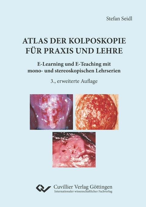 Atlas der Kolposkopie f&#xFC;r Praxis und Lehre -  Stefan Seidl