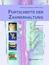 Fortschritte der Zahnerhaltung - 