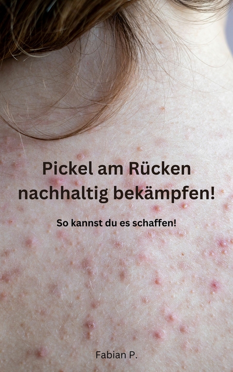 Pickel am Rücken nachhaltig bekämpfen! - Fabian P.