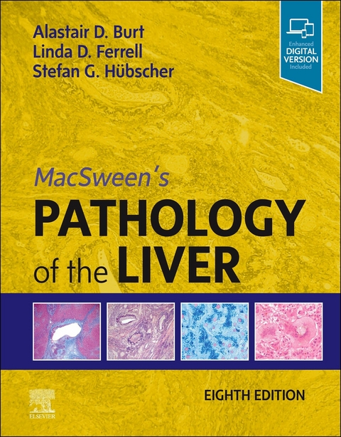 MacSween's Pathology of the Liver, E-Book -  Alastair D. Burt,  Linda D. Ferrell,  Stefan G. Hubscher