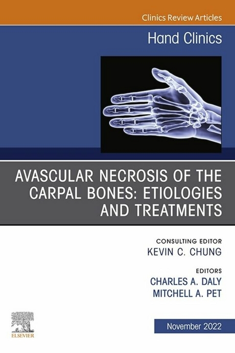 Avascular Necrosis of the Carpal Bones: Etiologies and Treatments, An Issue of Hand Clinics, E-Book - 