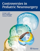 Controversies in Pediatric Neurosurgery - 