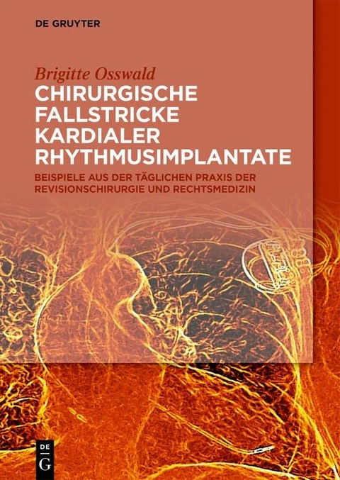 Chirurgische Fallstricke kardialer Rhythmusimplantate -  Brigitte Osswald