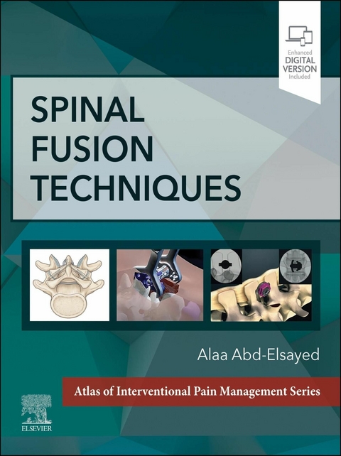 Spinal FusionTechniques -  Alaa Abd-Elsayed