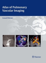 Atlas of Pulmonary Vascular Imaging - Conrad Wittram