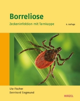 Borreliose - Fischer, Ute