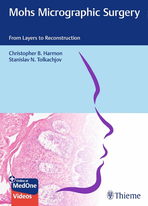 Mohs Micrographic Surgery: From Layers to Reconstruction -  Christopher B. Harmon,  Stanislav N. Tolkachjov