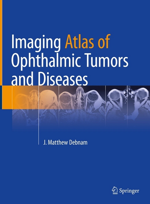 Imaging Atlas of Ophthalmic Tumors and Diseases - 