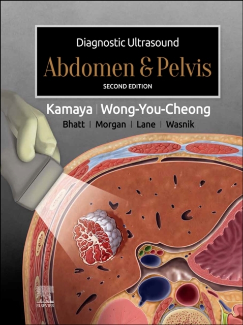 Diagnostic Ultrasound: Abdomen and Pelvis -  Aya Kamaya,  Jade Wong-You-Cheong