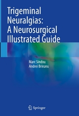 Trigeminal Neuralgias: A Neurosurgical Illustrated Guide -  Marc Sindou,  Andrei Brinzeu