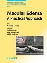 Macular Edema - 