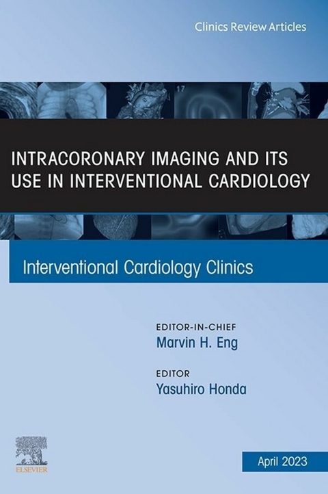 Intracoronary Imaging and its use in Interventional Cardiology, An Issue of Interventional Cardiology Clinics, E-Book - 