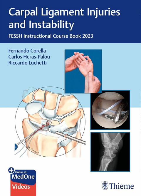 Carpal Ligament Injuries and Instability - 