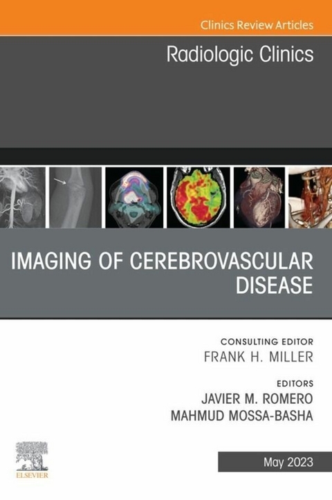 Imaging of Cerebrovascular Disease, An Issue of Radiologic Clinics of North America, E-Book - 