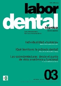 Labor Dental Técnica Nº3 Vol.25